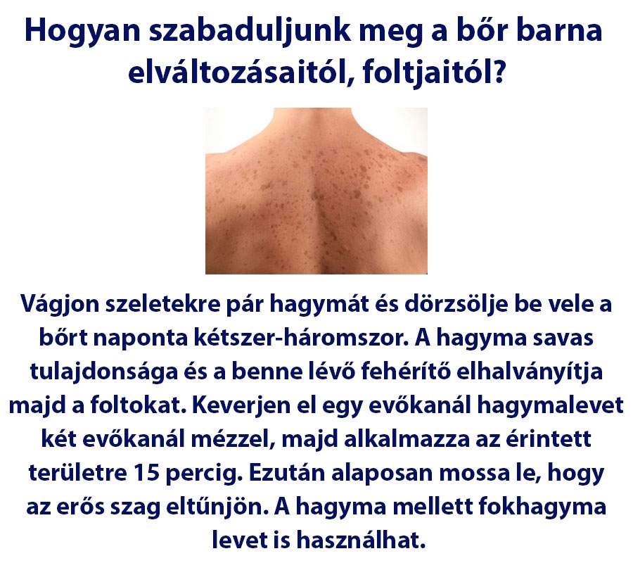 Hogyan szabaduljunk meg a bőr barna  elváltozásaitól, foltjaitól?
