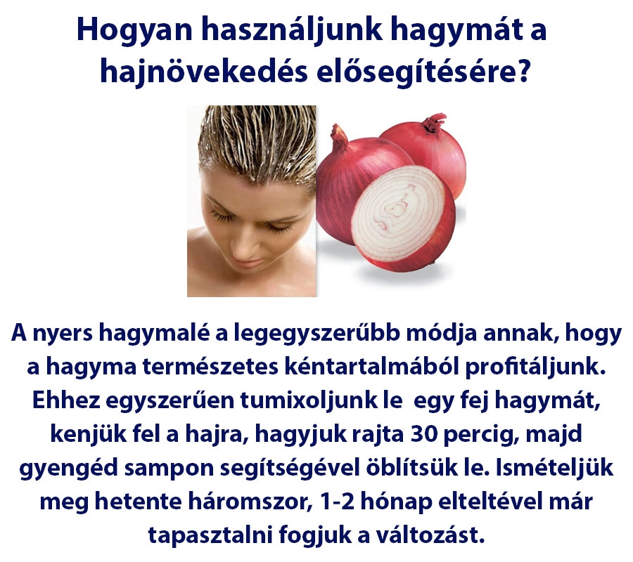 Hogyan használjunk hagymát a hajnövekedés elősegítésére?