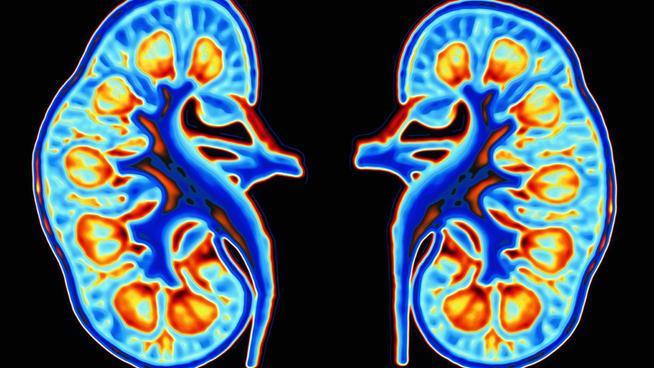 A vesebetegségek 10 fontos jele, amit ismernie kell