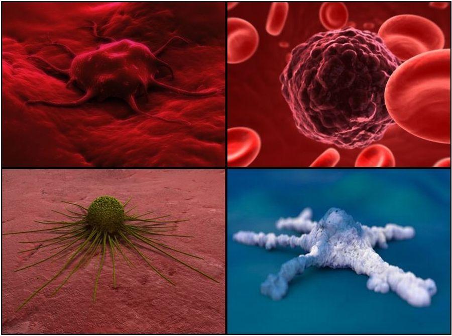 Biztos megoldás a rák és a szívbetegségek csökkentésére