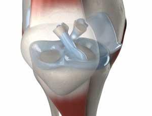 10 étel, amit semmiképpen ne fogyasszon, ha ízületi fájdalomban szenved