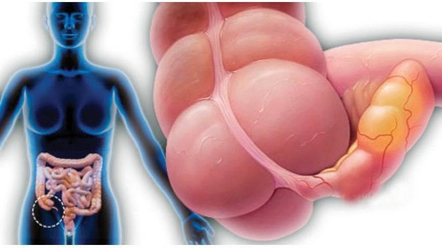 A vakbélgyulladás 5 különleges jele a hasi fájdalmon kívül