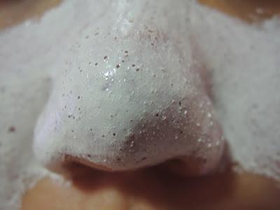 Hogyan szabaduljunk meg a mitesszerektől?