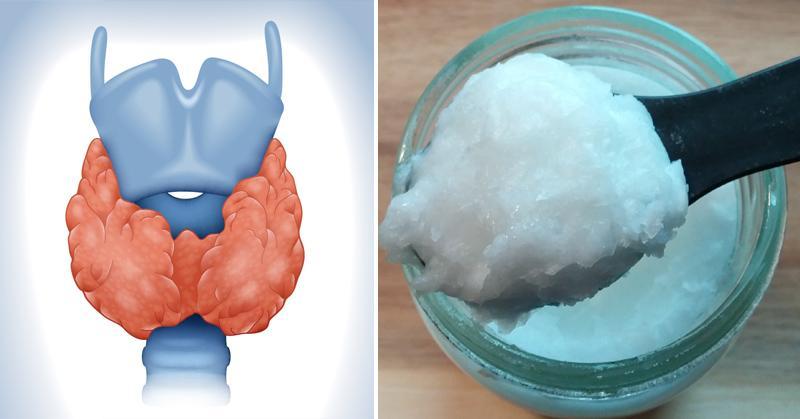 Hogyan segíthet a kókuszolaj pajzsmirigy problémák esetén?