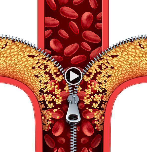 A rossz vérkeringés legfontosabb jelei - videó