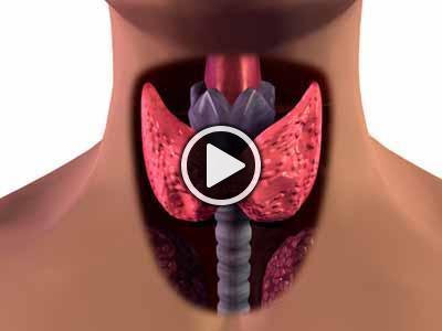 Pajzsmirigy betegek diétája