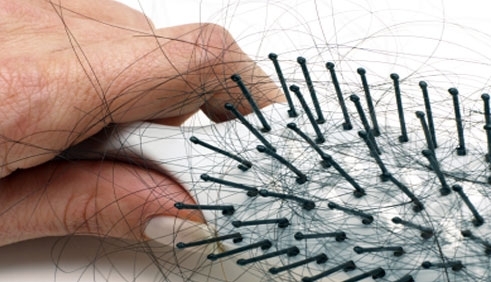 Stressz és kopaszodás