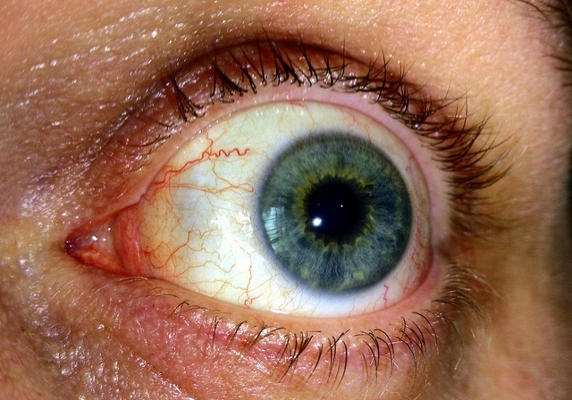 Hogyan kezelje szeme fáradtságát?